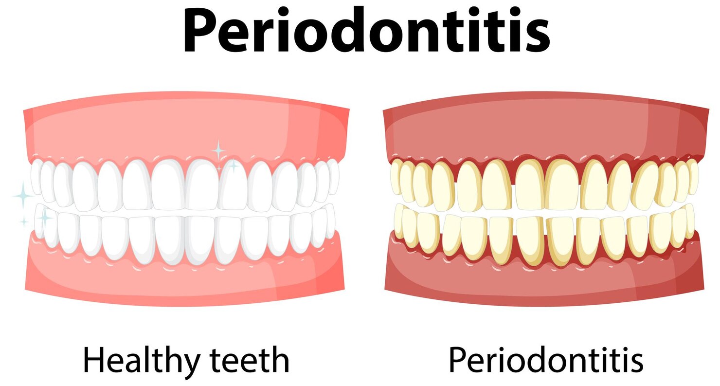Periodontics