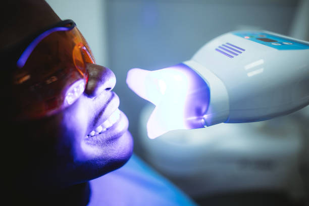 Teeth Whitening